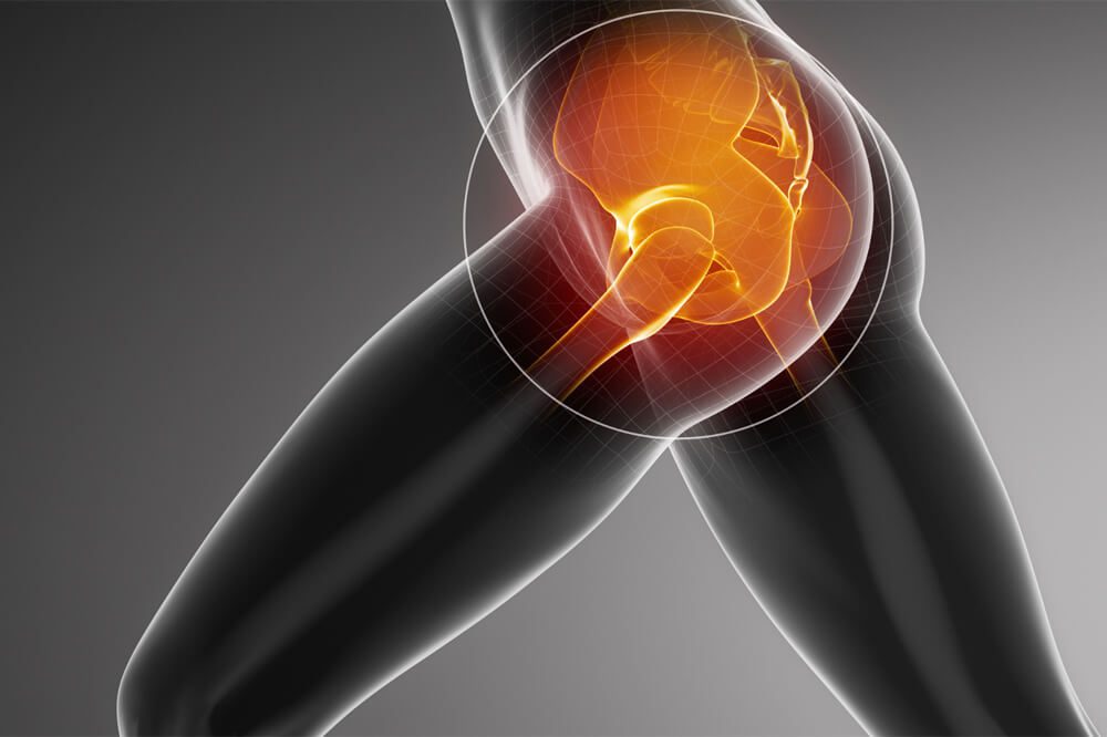 5 signs your hip has poor alignment